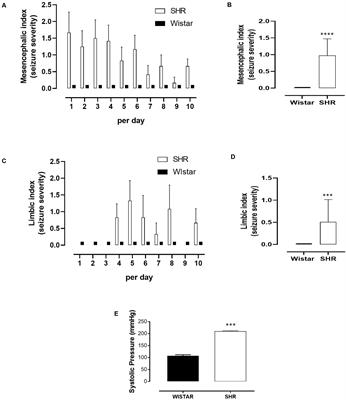 Epilepsy Seizures in Spontaneously Hypertensive Rats After Acoustic Stimulation: Role of Renin–Angiotensin System